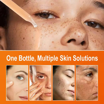 Vitamin C Brightening Serum 30ml – Dark Spot Fader & Glow Booster